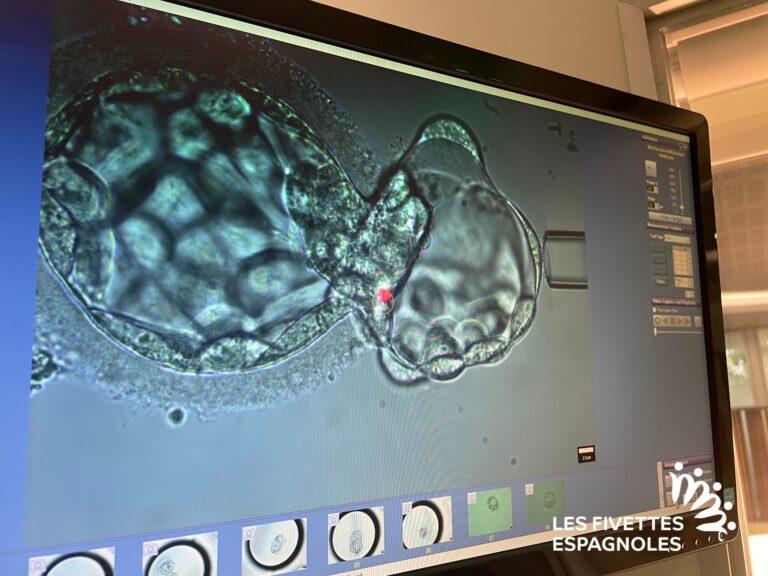 IVF Donostia (15)