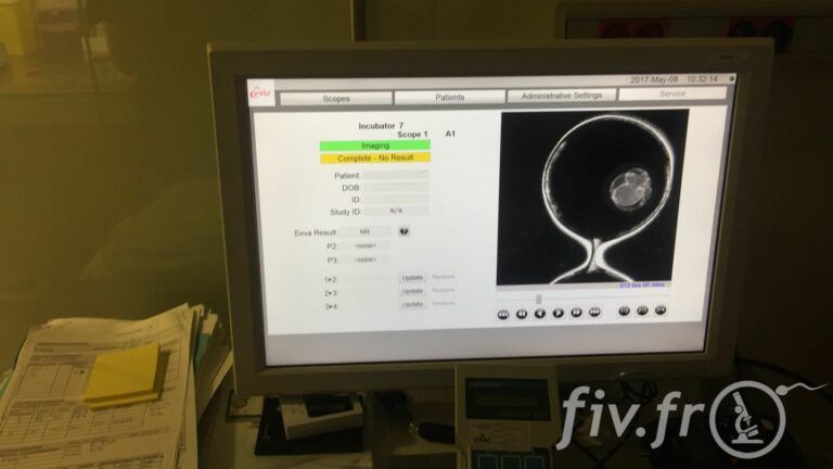 IVF Life Alicante (18)